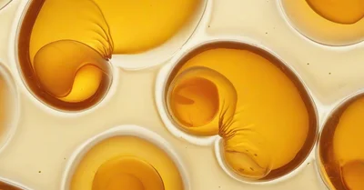 腸-関節軸って本当？酪酸菌ポストバイオティクスRCTの正直な結果と私の結論